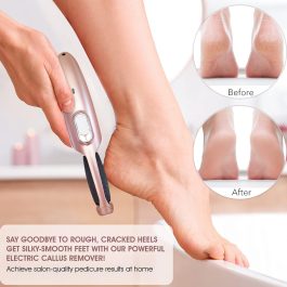 Foot Calluses Remover